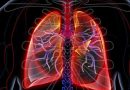Analizan si enfermos con neumonía por COVID-19 desarrollan fibrosis pulmonar
