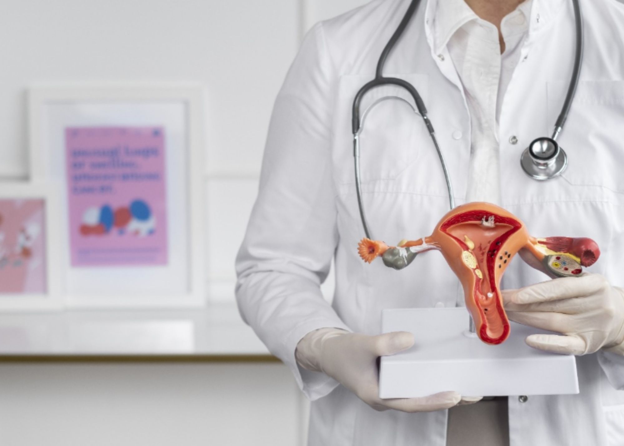 Nuevos tratamientos menos invasivos amplían las opciones para mujeres con endometriosis y miomas Nuevos tratamientos menos invasivos amplían las opciones para mujeres con endometriosis y miomas